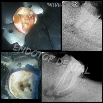 Endodontie